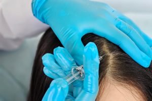Cosmetologist,Does,Prp,Therapy,Against,Hair,Loss,And,Anti-dandruff,Of