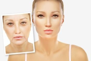 After Before shuterstock Images