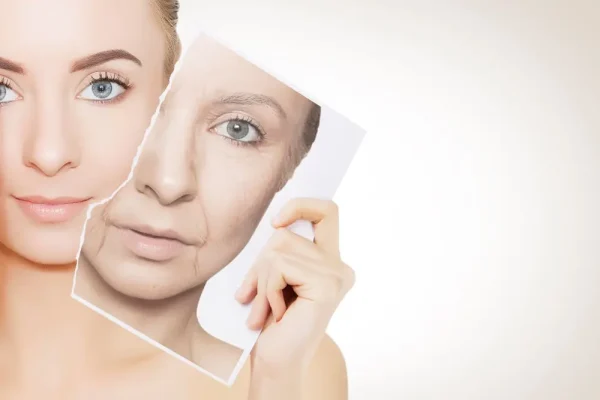 Anti Wrinkle Botox Results